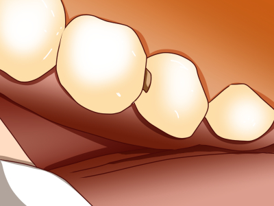 ある フロス 臭い ところが なぜ歯間ブラシが臭いのか？3つの原因と対策方法